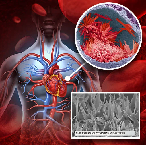 CardioFlush™ Benefits